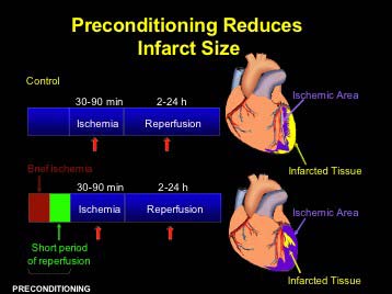 preconditioned